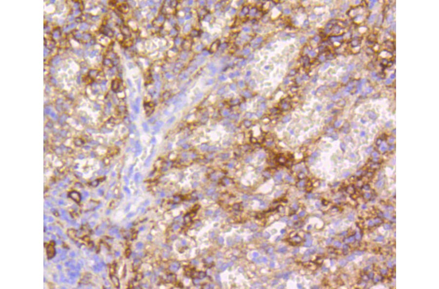 Immunohistochemistry - Anti-VCAM1 Antibody (A11236) - Antibodies.com