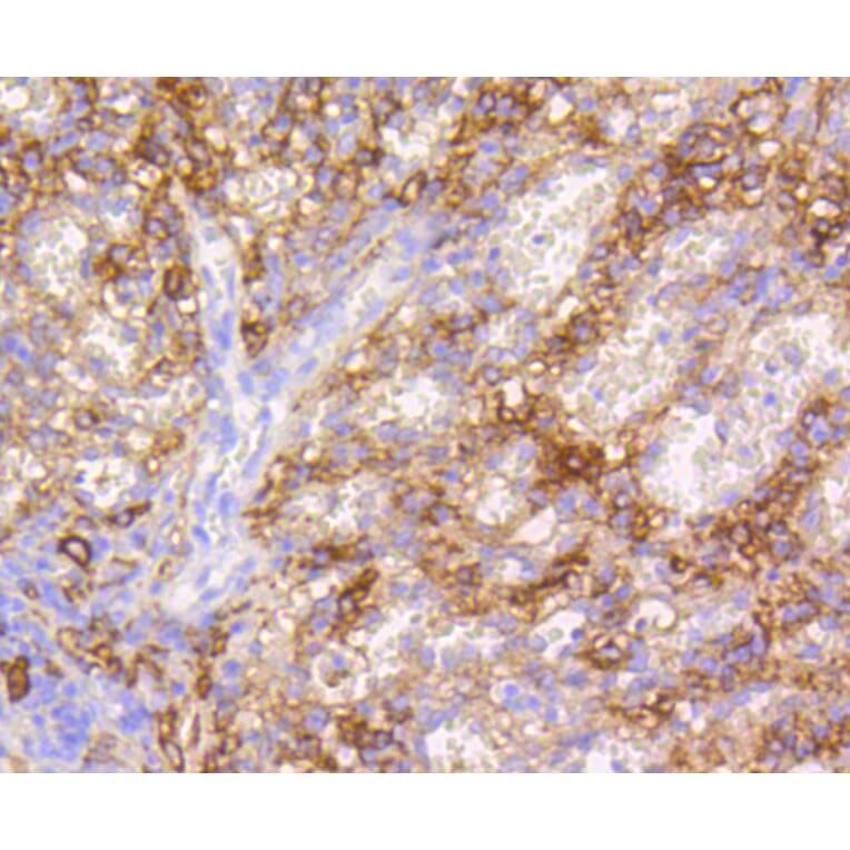 Immunohistochemistry - Anti-VCAM1 Antibody (A11236) - Antibodies.com