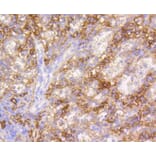 Immunohistochemistry - Anti-VCAM1 Antibody (A11236) - Antibodies.com