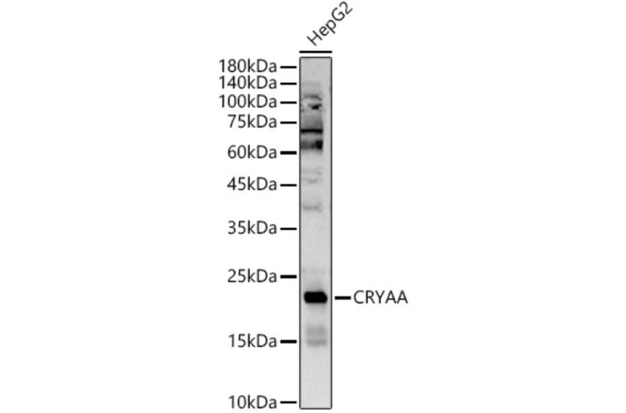 Western Blot - Anti-alpha A Crystallin/CRYAA Antibody (A16759) - Antibodies.com