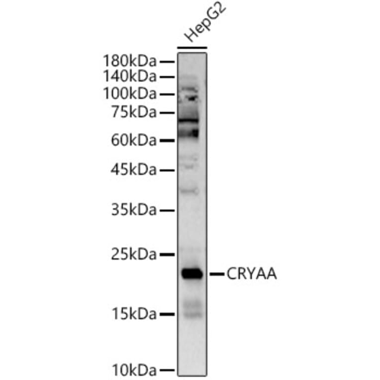 Western Blot - Anti-alpha A Crystallin/CRYAA Antibody (A16759) - Antibodies.com