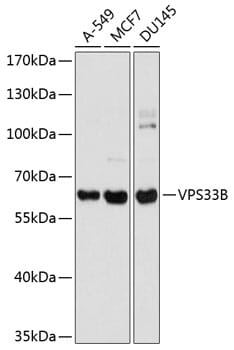 Western blot analysis of extracts of various cell lines, using Anti-VPS33B Antibody (A8799) at 1:1,000 dilution.
Secondary antibody: Goat Anti-Rabbit IgG (H+L) (HRP) (AS014) at 1:10,000 dilution.
Lysates / proteins: 25µg per lane.
Blocking buffer: 3% non-fat dry milk in TBST.
Detection: ECL Basic Kit (RM00020).
Exposure time: 1s.