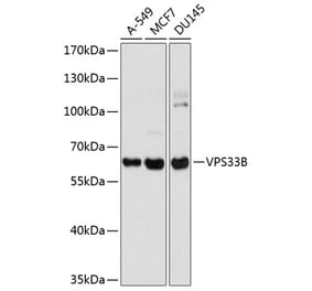 Western Blot - Anti-VPS33B Antibody (A16760) - Antibodies.com