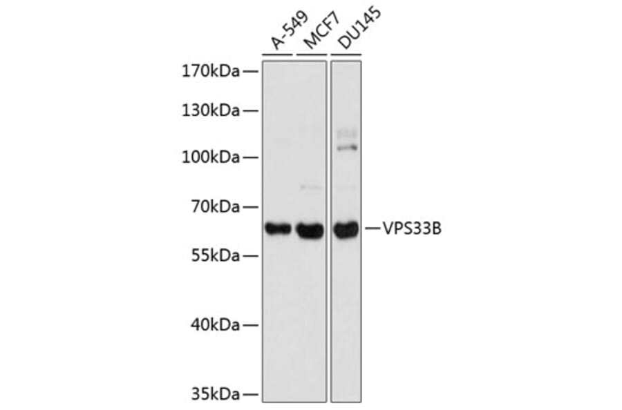 Western Blot - Anti-VPS33B Antibody (A16760) - Antibodies.com
