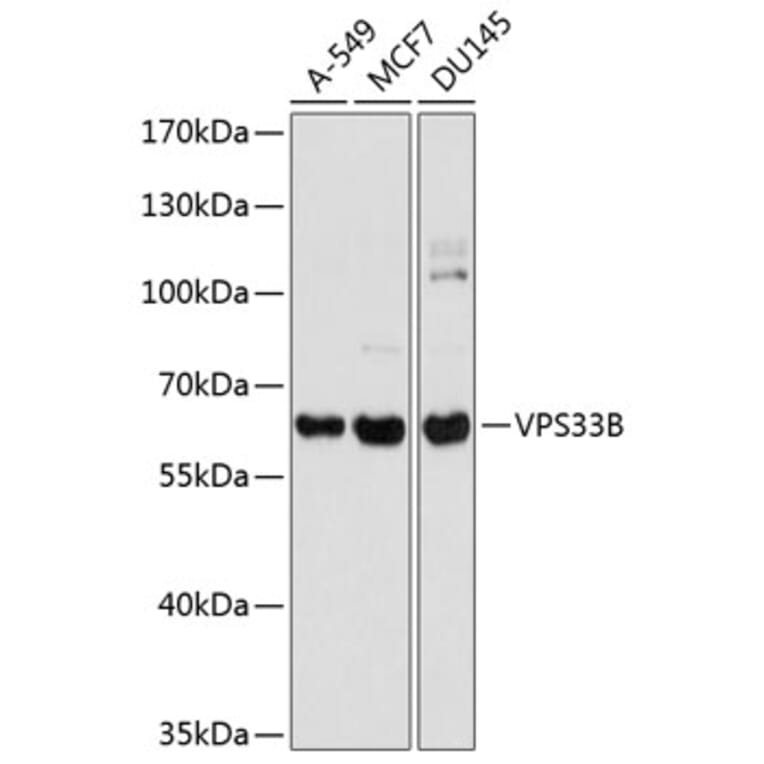 Western Blot - Anti-VPS33B Antibody (A16760) - Antibodies.com