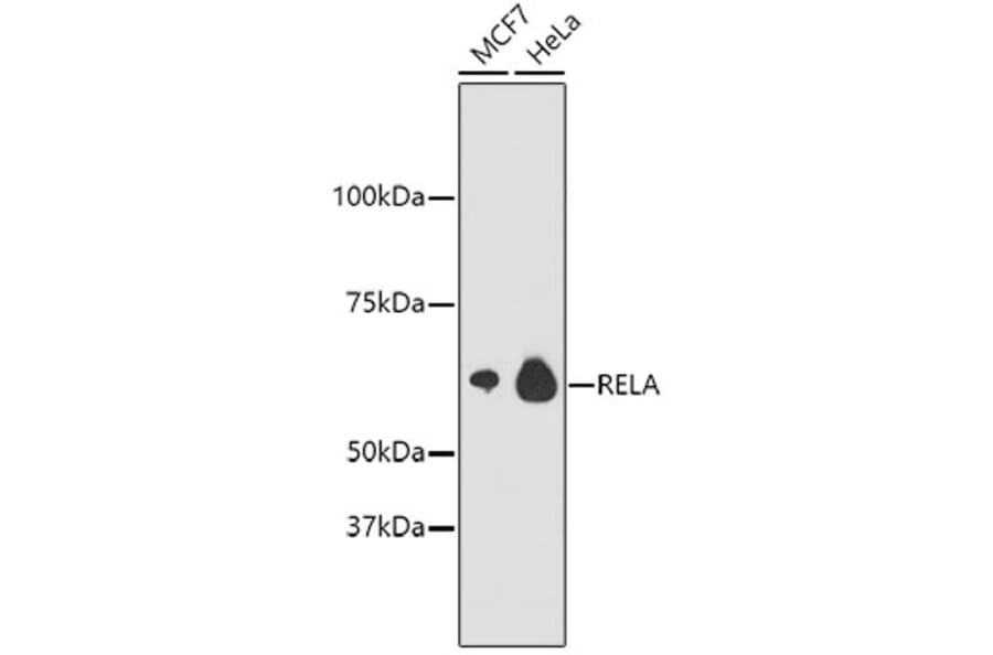 Western Blot - Anti-RELA Antibody (A11155) - Antibodies.com