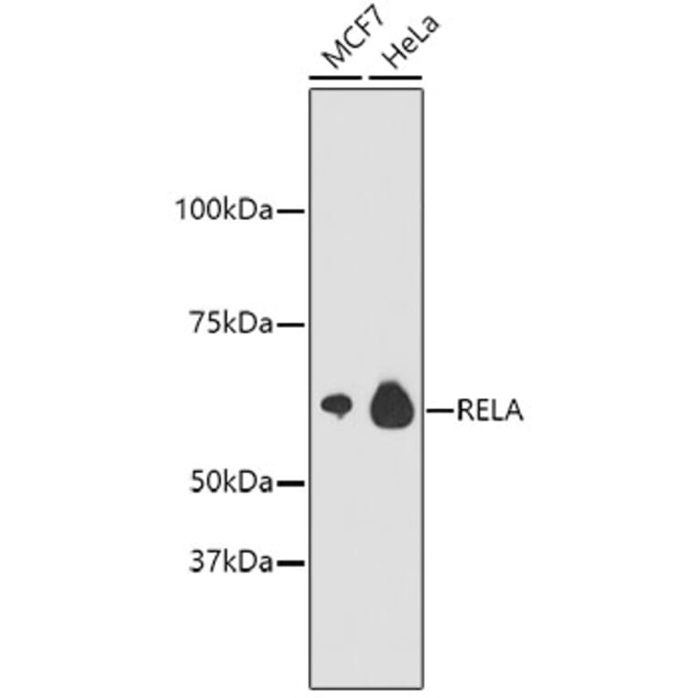 Western Blot - Anti-RELA Antibody (A11155) - Antibodies.com