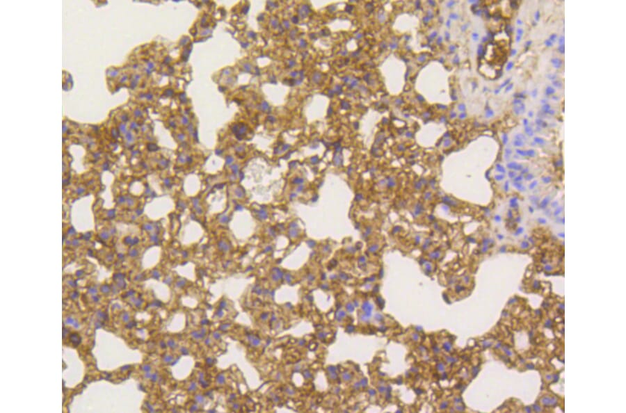 Immunohistochemistry - Anti-RELA Antibody (A11155) - Antibodies.com