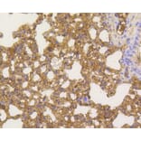 Immunohistochemistry - Anti-RELA Antibody (A11155) - Antibodies.com