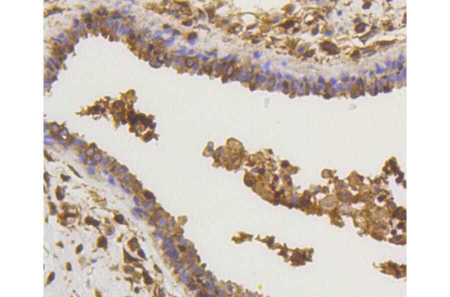 Immunohistochemistry - Anti-RELA Antibody (A11155) - Antibodies.com