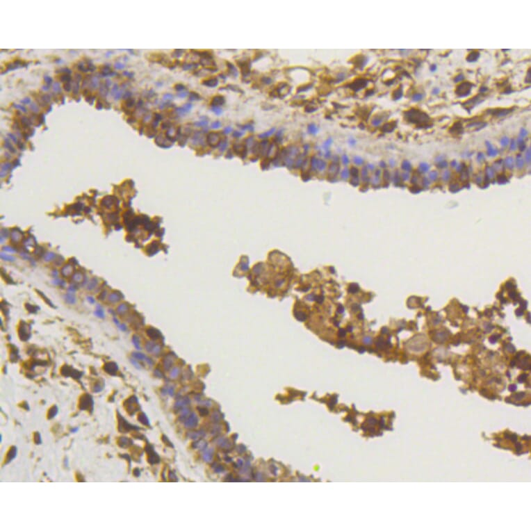 Immunohistochemistry - Anti-RELA Antibody (A11155) - Antibodies.com