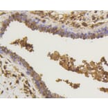 Immunohistochemistry - Anti-RELA Antibody (A11155) - Antibodies.com
