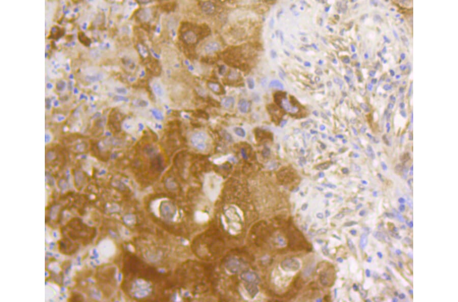 Immunohistochemistry - Anti-RELA Antibody (A11155) - Antibodies.com
