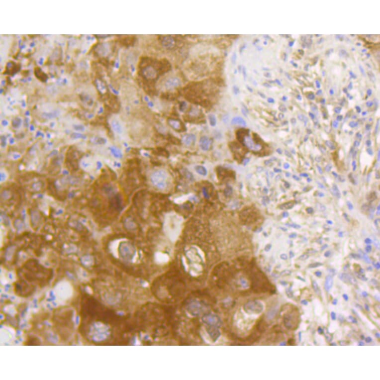 Immunohistochemistry - Anti-RELA Antibody (A11155) - Antibodies.com
