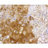 Immunohistochemistry - Anti-RELA Antibody (A11155) - Antibodies.com