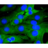 Immunofluorescence - Anti-RELA Antibody (A11155) - Antibodies.com