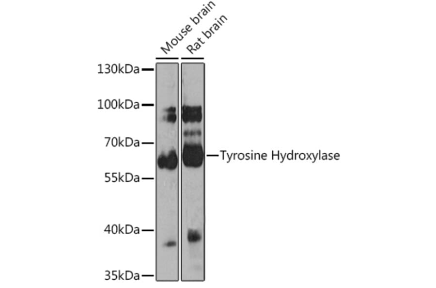 Western Blot - Anti-Tyrosine Hydroxylase Antibody (A16765) - Antibodies.com