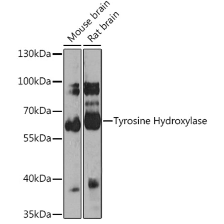 Western Blot - Anti-Tyrosine Hydroxylase Antibody (A16765) - Antibodies.com