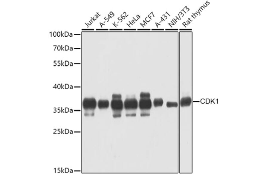 Western Blot - Anti-CDK1 Antibody (A0030) - Antibodies.com