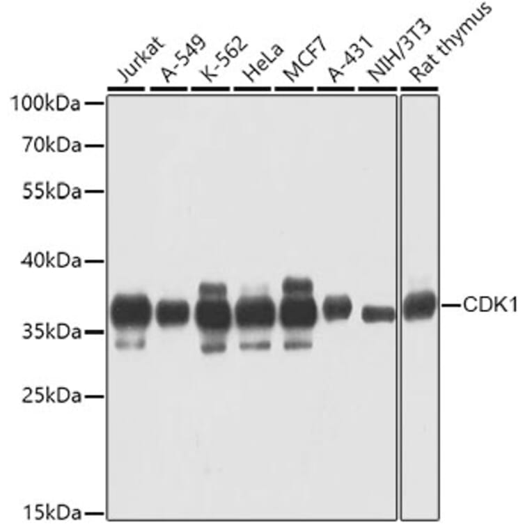Western Blot - Anti-CDK1 Antibody (A0030) - Antibodies.com