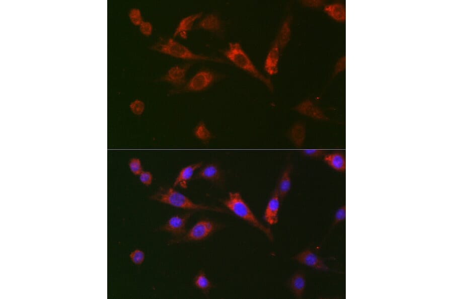 Immunofluorescence - Anti-GDF15 Antibody (A16768) - Antibodies.com