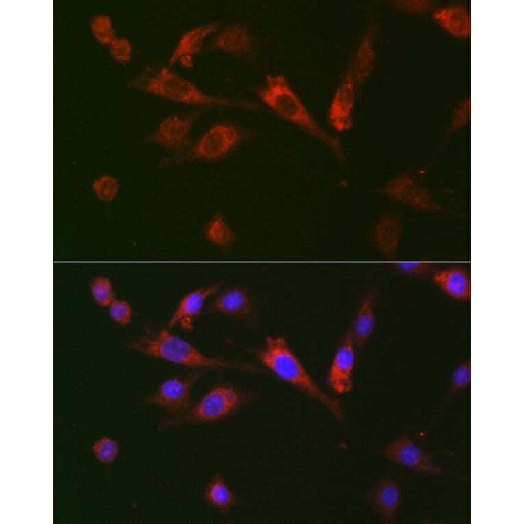 Immunofluorescence - Anti-GDF15 Antibody (A16768) - Antibodies.com