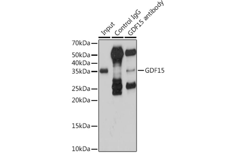 Western Blot - Anti-GDF15 Antibody (A16768) - Antibodies.com