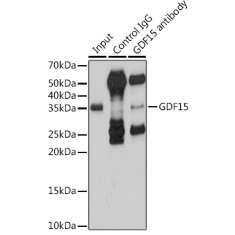 Western Blot - Anti-GDF15 Antibody (A16768) - Antibodies.com