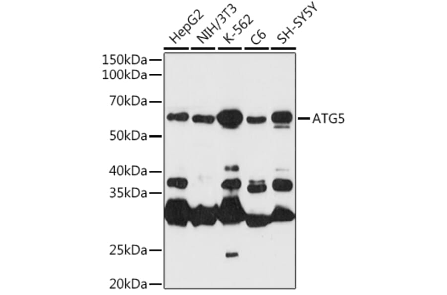 Western Blot - Anti-APG5L/ATG5 Antibody (A16769) - Antibodies.com