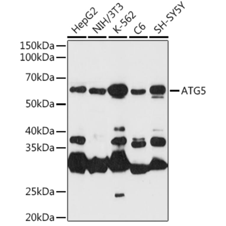 Western Blot - Anti-APG5L / ATG5 Antibody (A16769) - Antibodies.com