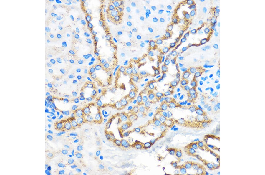 Immunohistochemistry - Anti-APG5L/ATG5 Antibody (A16769) - Antibodies.com