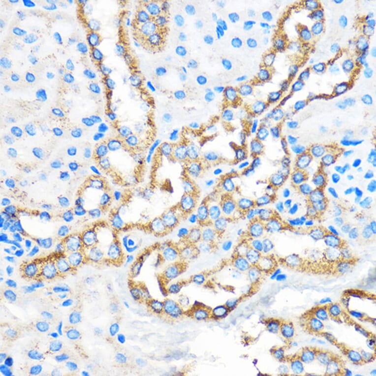 Immunohistochemistry - Anti-APG5L / ATG5 Antibody (A16769) - Antibodies.com