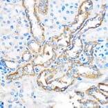 Immunohistochemistry - Anti-APG5L / ATG5 Antibody (A16769) - Antibodies.com