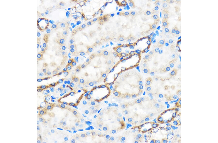 Immunohistochemistry - Anti-APG5L/ATG5 Antibody (A16769) - Antibodies.com