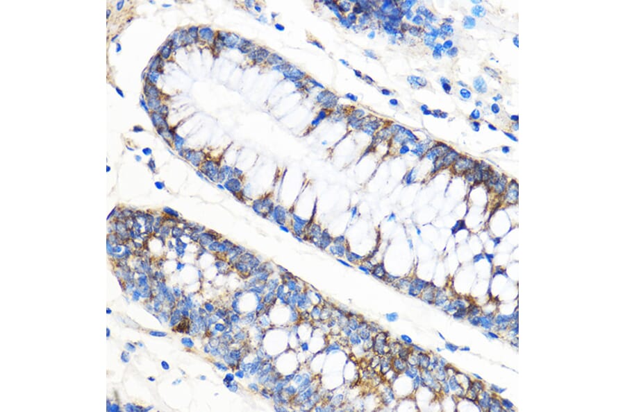 Immunohistochemistry - Anti-APG5L/ATG5 Antibody (A16769) - Antibodies.com