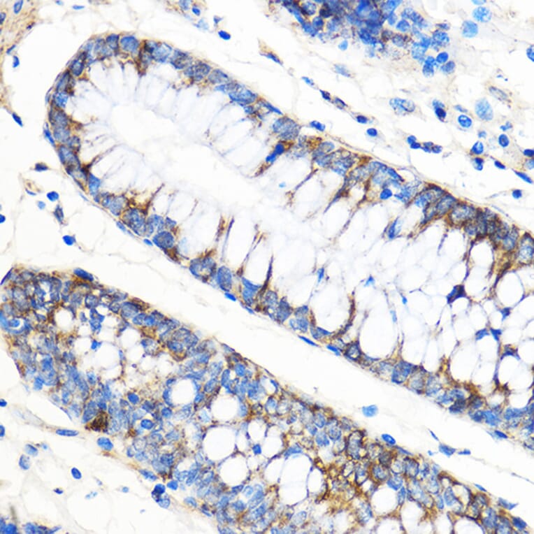 Immunohistochemistry - Anti-APG5L / ATG5 Antibody (A16769) - Antibodies.com