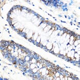 Immunohistochemistry - Anti-APG5L / ATG5 Antibody (A16769) - Antibodies.com