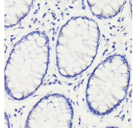 Immunohistochemistry - Anti-p53 Antibody (A16771) - Antibodies.com