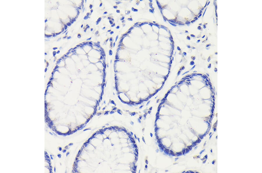 Immunohistochemistry - Anti-p53 Antibody (A16771) - Antibodies.com