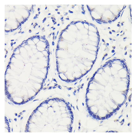 Immunohistochemistry - Anti-p53 Antibody (A16771) - Antibodies.com