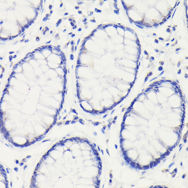 Immunohistochemistry - Anti-p53 Antibody (A16771) - Antibodies.com
