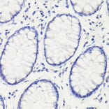 Immunohistochemistry - Anti-p53 Antibody (A16771) - Antibodies.com