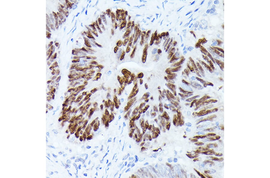 Immunohistochemistry - Anti-p53 Antibody (A16771) - Antibodies.com