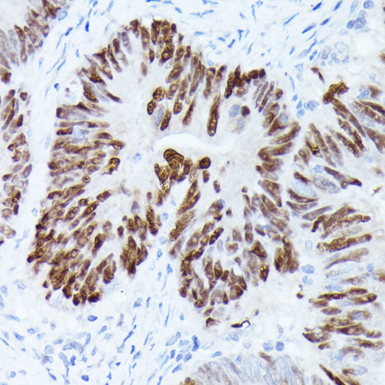Immunohistochemistry - Anti-p53 Antibody (A16771) - Antibodies.com