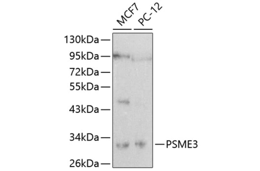 Western Blot - Anti-PSME3 Antibody (A16772) - Antibodies.com