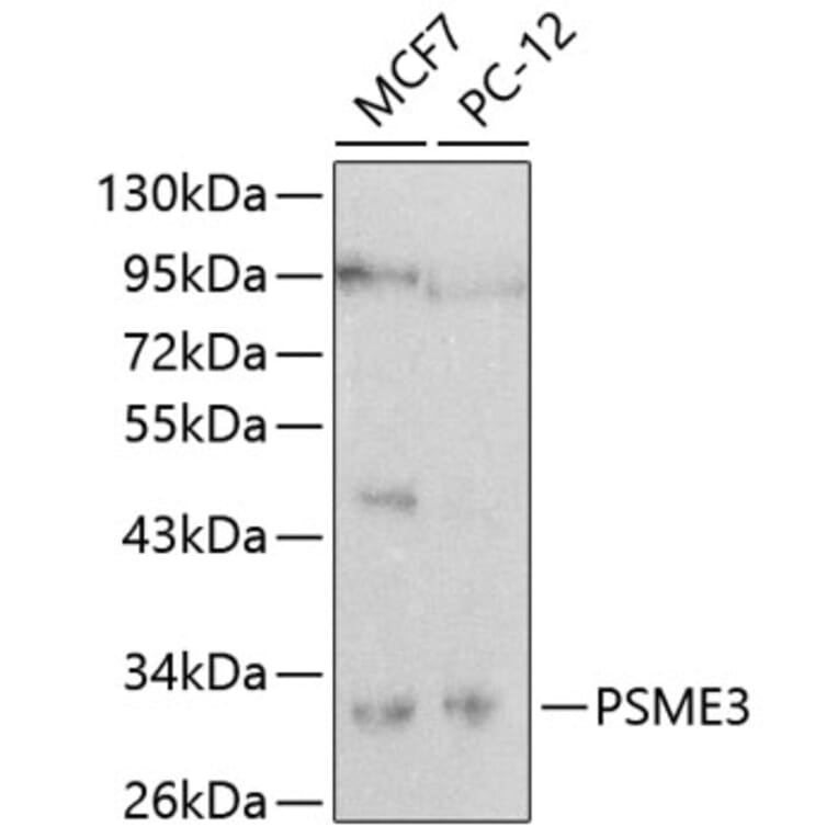 Western Blot - Anti-PSME3 Antibody (A16772) - Antibodies.com