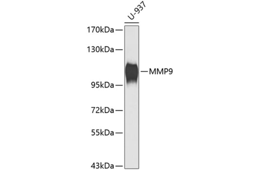 Western Blot - Anti-MMP9 Antibody (A0311) - Antibodies.com