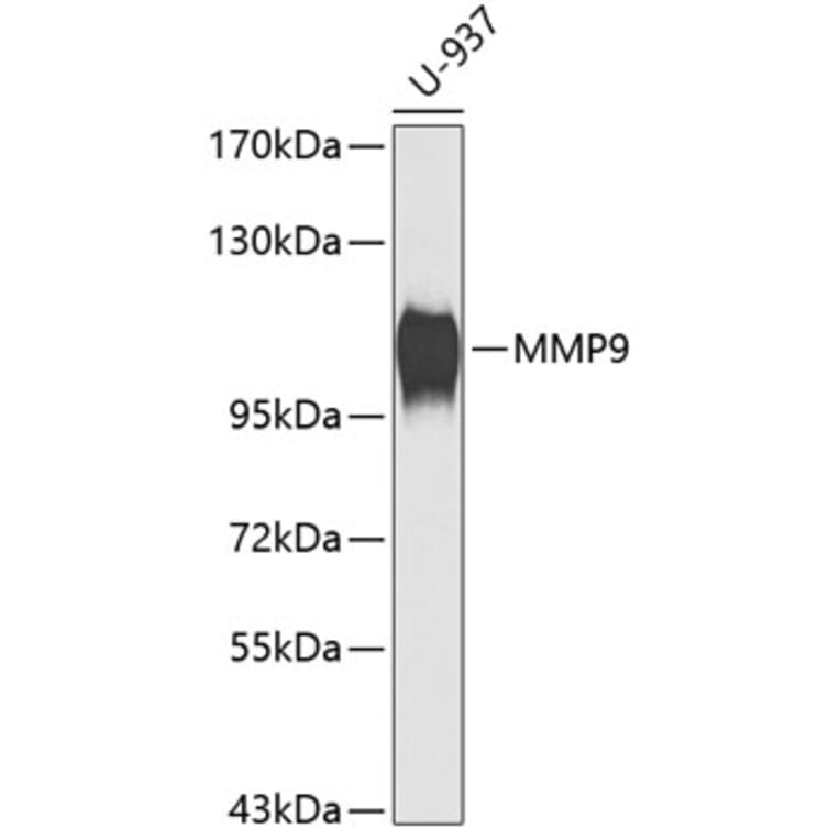Western Blot - Anti-MMP9 Antibody (A0311) - Antibodies.com