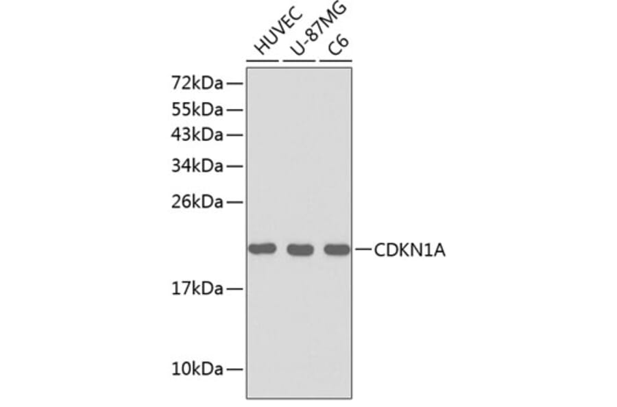 Western Blot - Anti-CDKN1A Antibody (A0319) - Antibodies.com