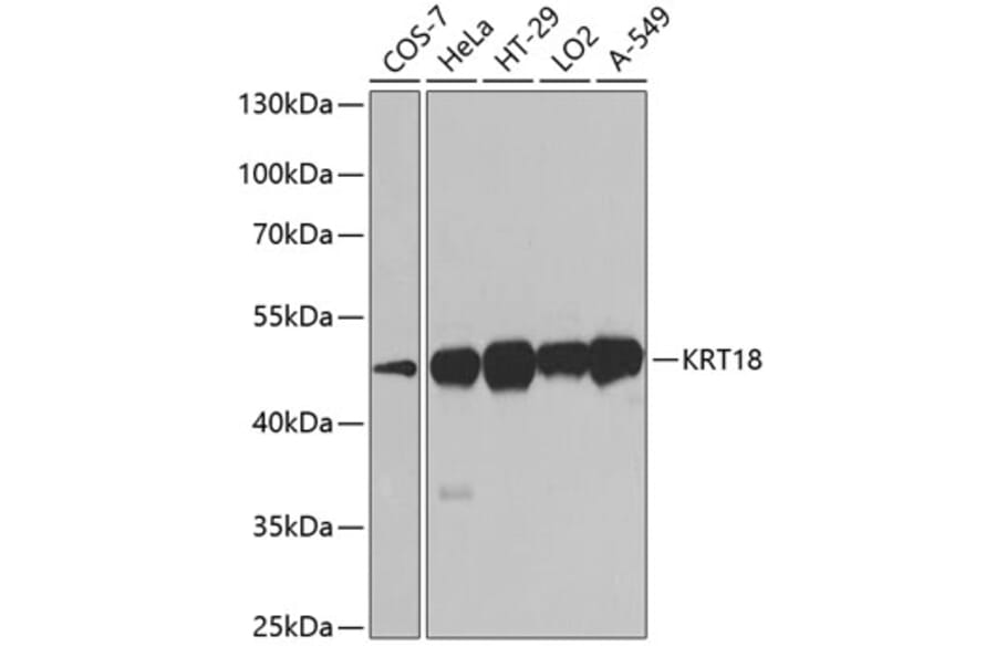 Western Blot - Anti-KRT18 Antibody (A0389) - Antibodies.com